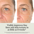 Lifestyle image of Therabody TheraFace Mask Glo