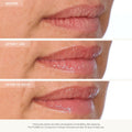 Before and after results of using U Beauty The Plasma Lip Compound (Universal)