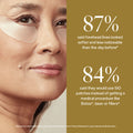 Information related to SIO FaceLift