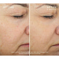 Ourself Brightening Peel Kit before and after image .