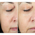 Ourself Brightening Peel Kit before and after image 2 .
