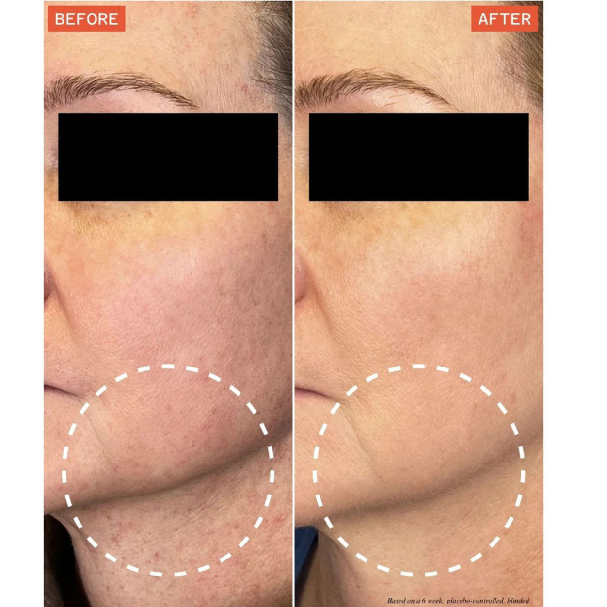 Before and after results of using Dr. Few DermaReverse