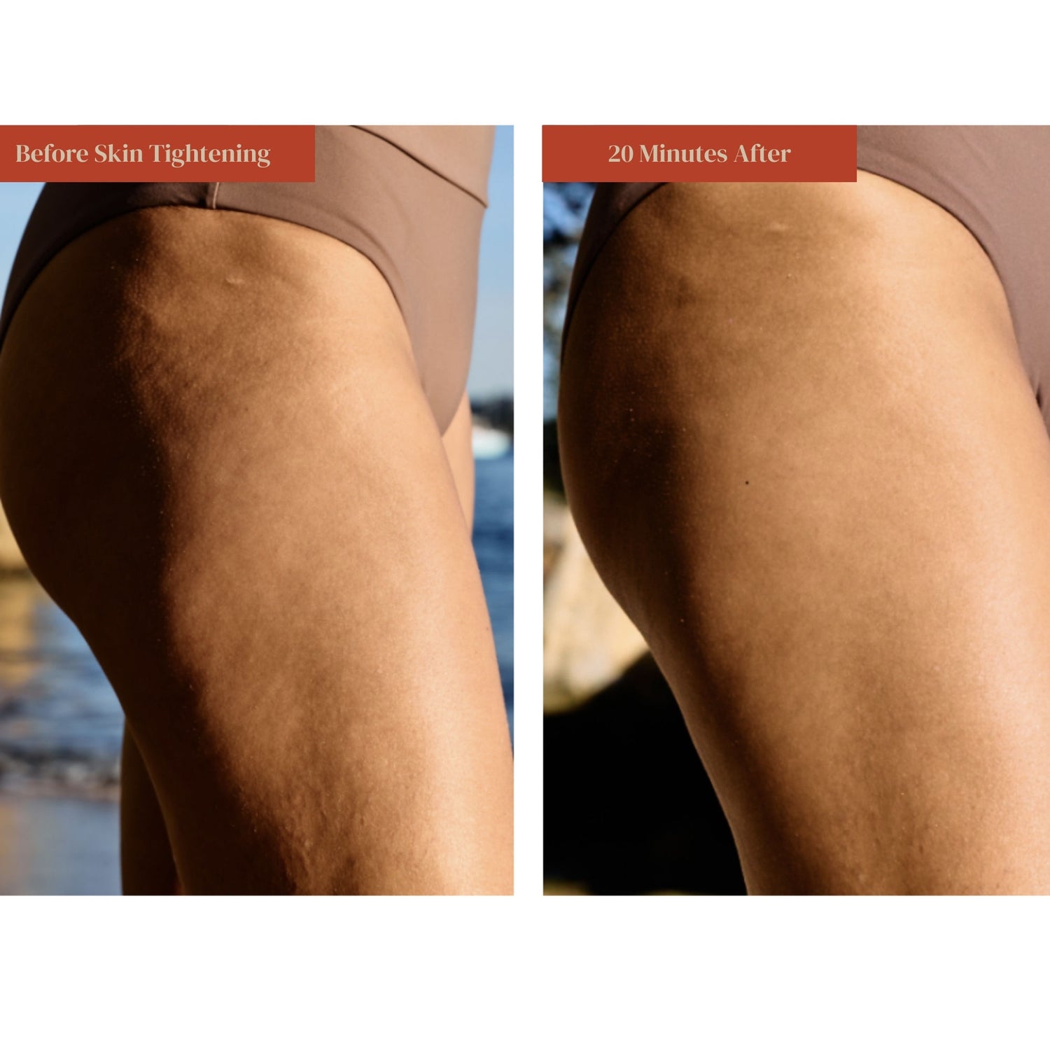 Before and after results of using Dr. Few Skin Tightening + SPF 30