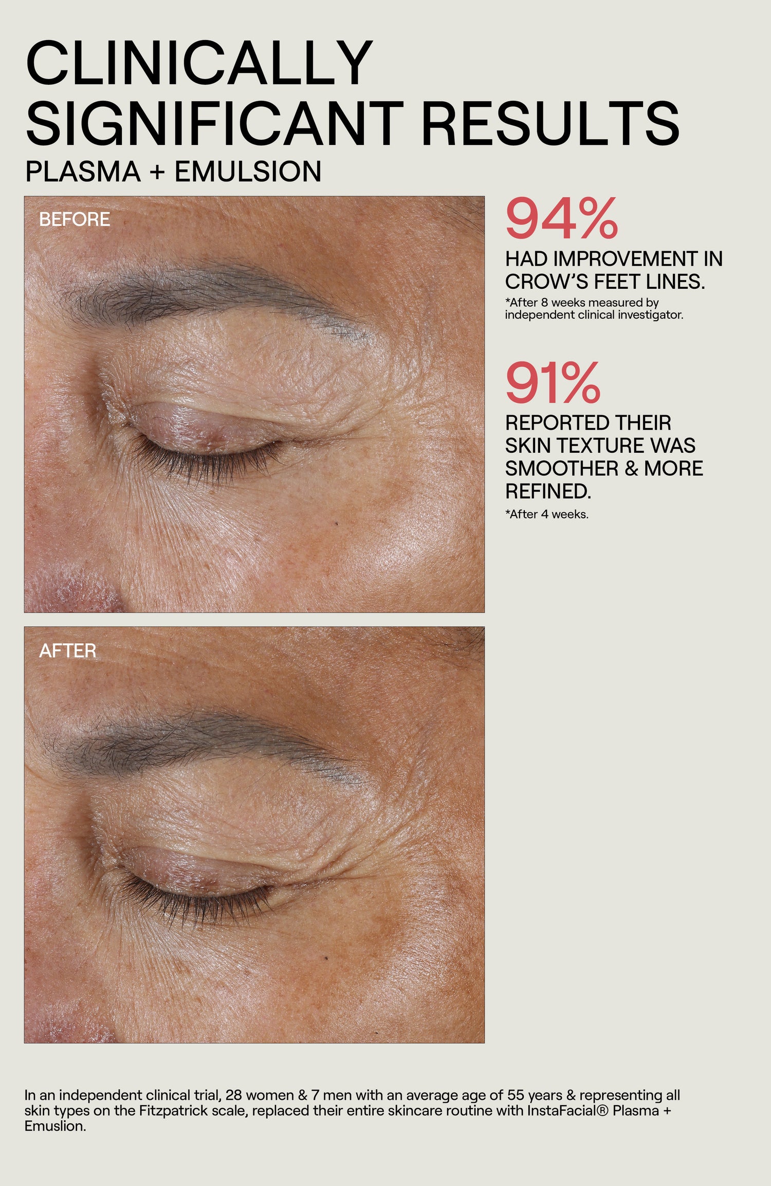 Before and after results of using Dr. Diamond’s Metacine InstaFacial Collection Set