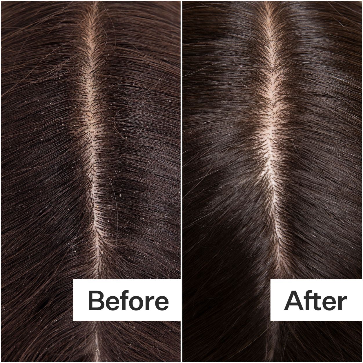 Before and after results of using Act+Acre Cold Processed Cleanse Shampoo