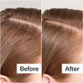 Before and after results of using Act+Acre Cold Processed Scalp Detox