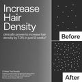 Information related to Act+Acre 3% Stem Cell Peptide H3-Grow+ Complex Scalp Treatment