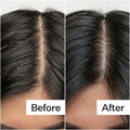 Before and after results of using Act+Acre Salicylic Acid Scalp Exfoliator