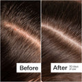 Before and after results of using Act+Acre Microbiome Cooling Scalp Serum