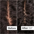 Before and after results of using Act+Acre Microbiome Cooling Scalp Serum