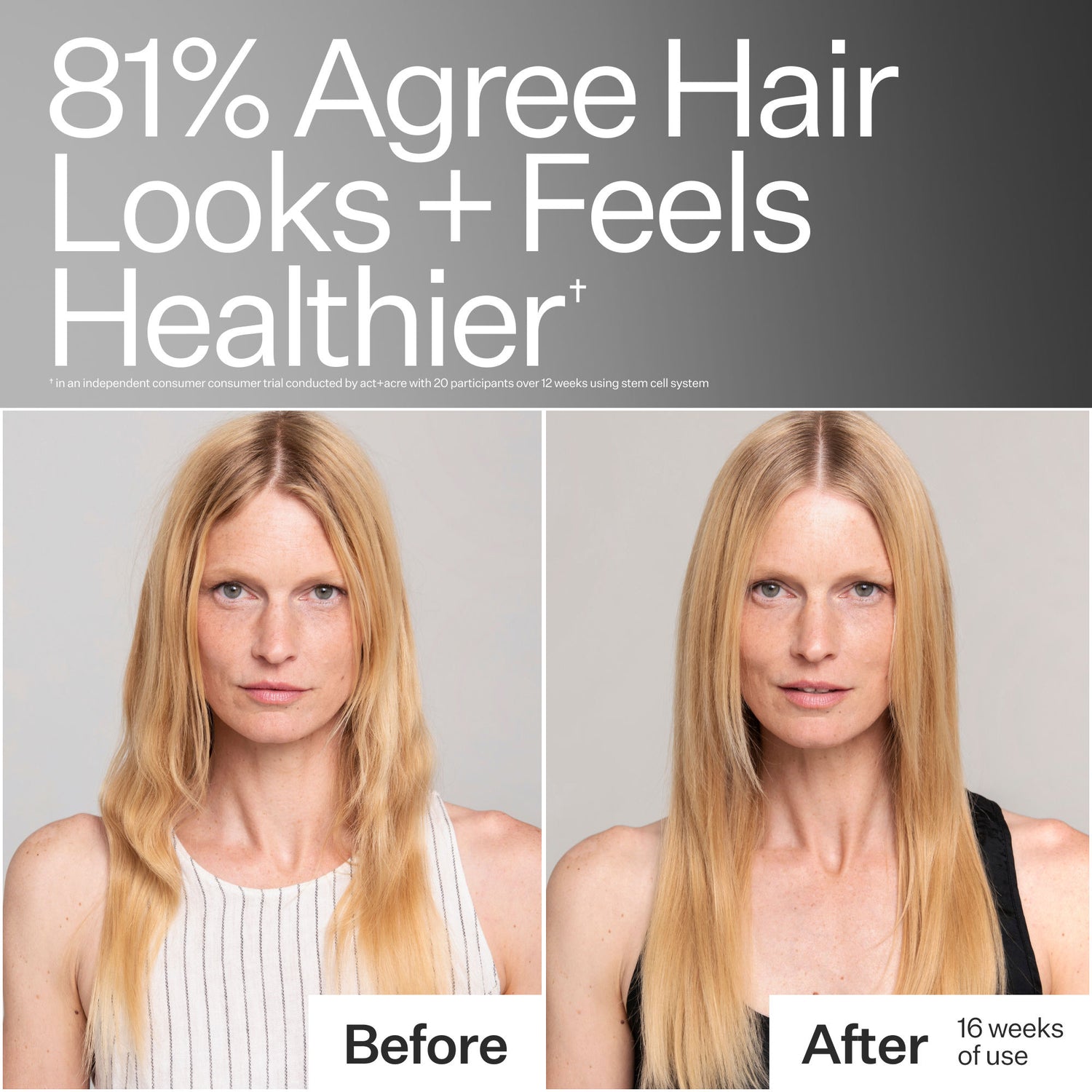 Before and after results of using Act+Acre Stem Cell Conditioner For Thicker Fuller-Looking Hair