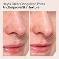 Before and after results of using Alpyn Beauty Clarifying Facial Oil with Retinol and Pink Algae