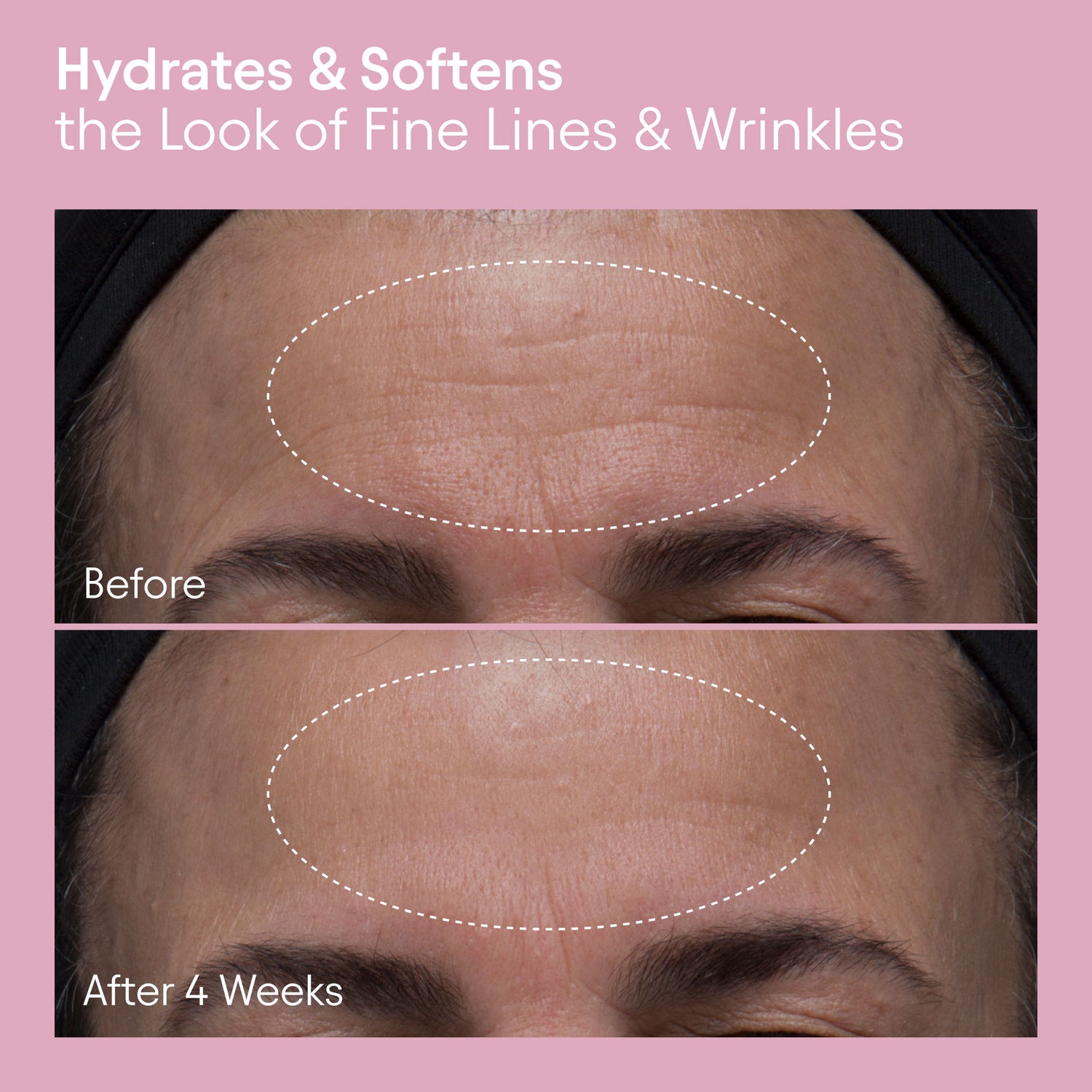 Before and after results of using Alpyn Beauty Melt Moisturizer for Firming, Plumping and Brightening
