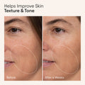 Before and after results of using Alpyn Beauty Hydrating Firming Serum with Niacinamide and Nettle