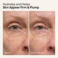 Before and after results of using Alpyn Beauty Hydrating Firming Serum with Niacinamide and Nettle