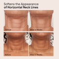 Before and after results of using Alpyn Beauty Super Sculpt Serum For Face and Neck with Tri-Peptide Firming Complex