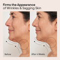 Before and after results of using Alpyn Beauty Super Sculpt Serum For Face and Neck with Tri-Peptide Firming Complex