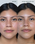 Before and after results of using Ranavat Renewing Bakuchi Crème Eternal Reign