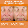 Before and after results of using BeautyStat Universal C Skin Refiner Vitamin C Serum + SPF 50 Mineral Sunscreen