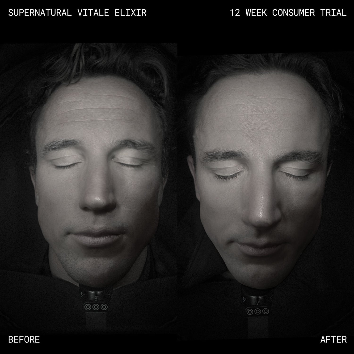 Before and after results of using Emma Lewisham Supernatural Vitale Face Elixir