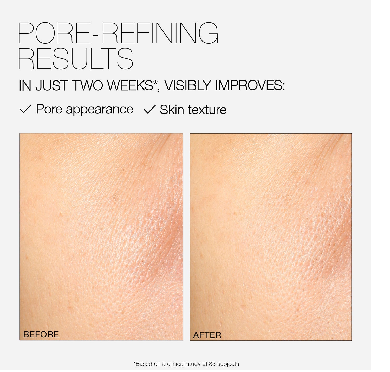 Before and after results of using Nars Natural Matte Longwear Foundation