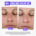 Before and after results of using Kiehl's Since 1851 Clearly Corrective Dark Spot Solution