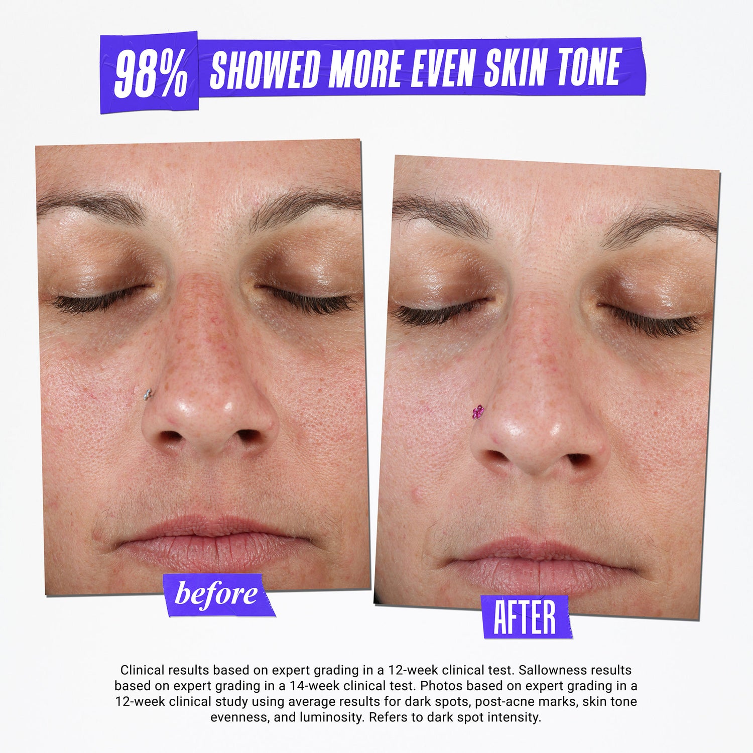 Before and after results of using Kiehl's Since 1851 Clearly Corrective Dark Spot Solution