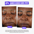 Before and after results of using Kiehl's Since 1851 Clearly Corrective Dark Spot Solution