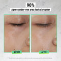 Before and after results of using Kiehl's Since 1851 Creamy Eye Treatment With Avocado