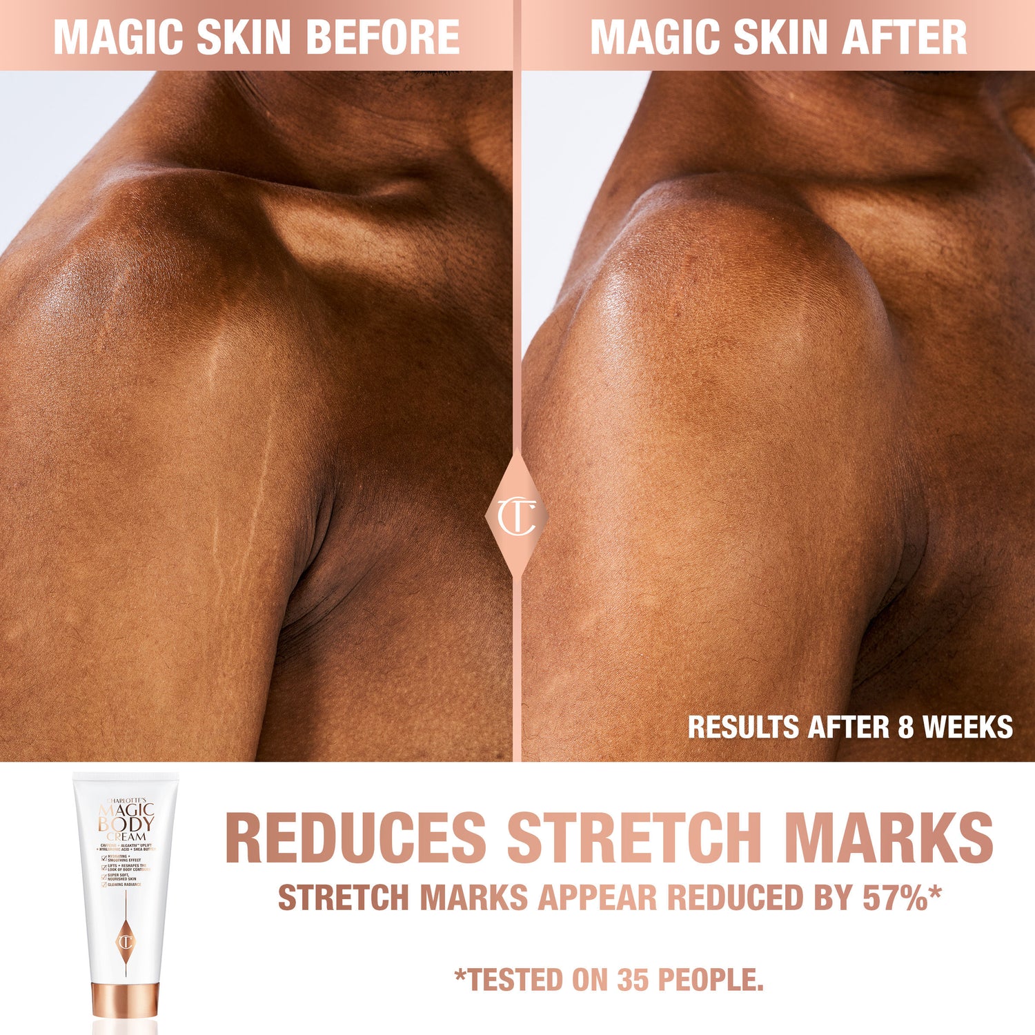 Before and after results of using Charlotte Tilbury Charlotte's Magic Body Cream