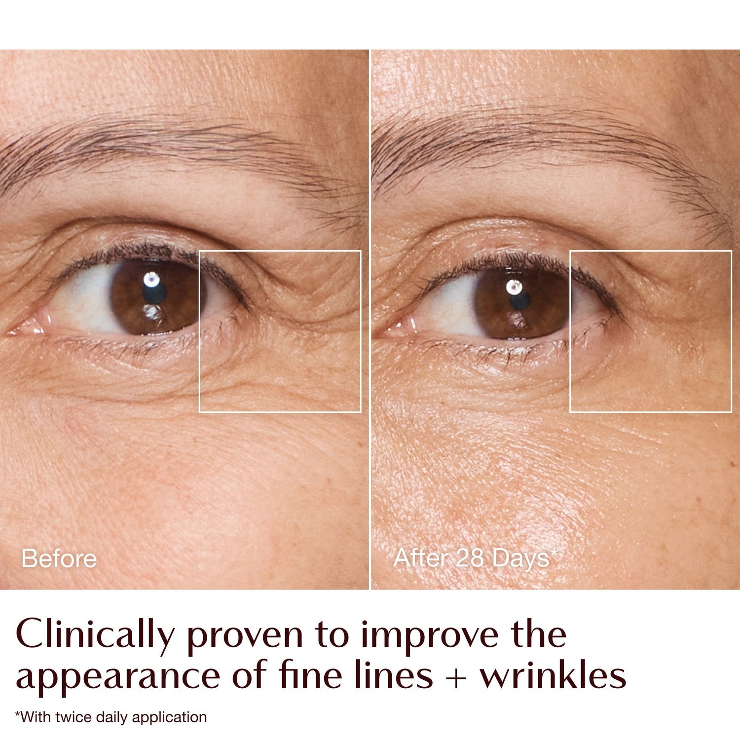 Before and after results of using Charlotte Tilbury Charlotte's Magic Cream