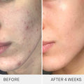 Before and after results of using Augustinus Bader The Cream