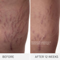 Before and after results of using Augustinus Bader The Body Cream