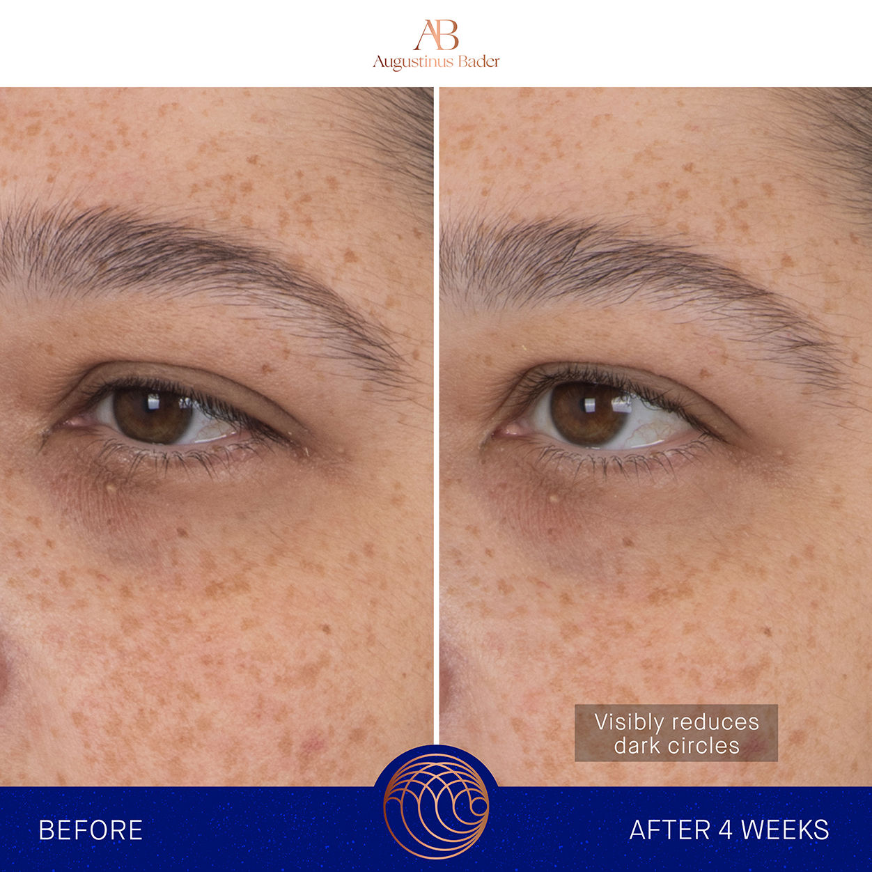 Before and after results of using Augustinus Bader The Eye Patches