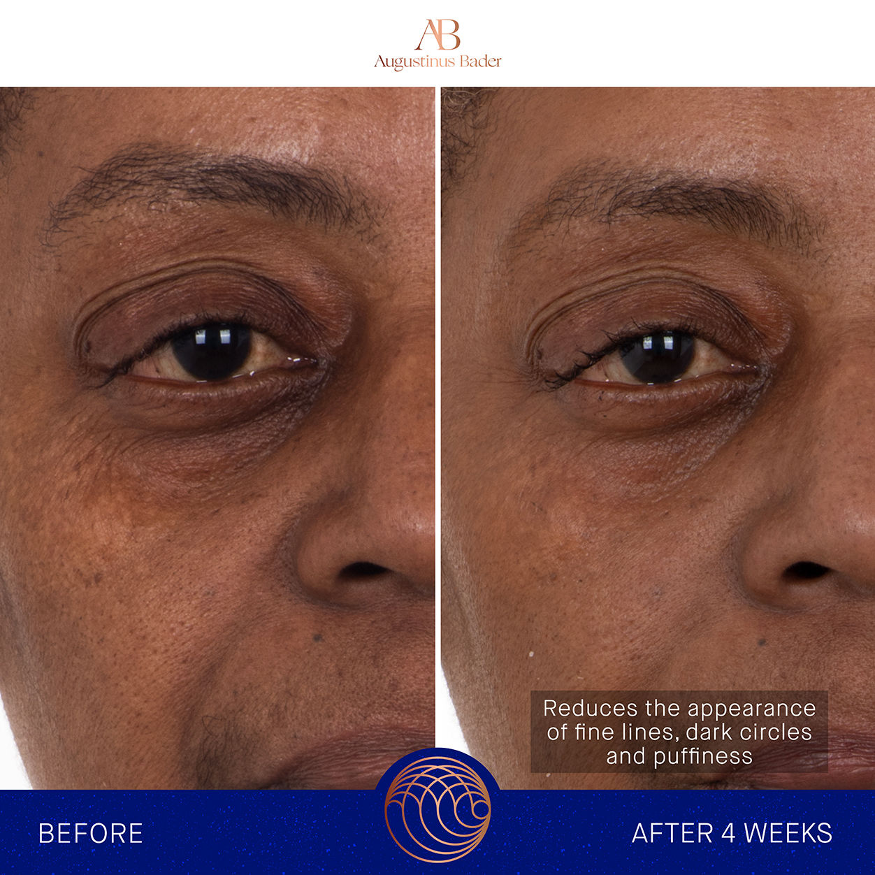 Before and after results of using Augustinus Bader The Eye Patches