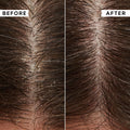 Before and after results of using Philip Kingsley Flaky Scalp Cleansing Shampoo variant: 8.4 fl oz