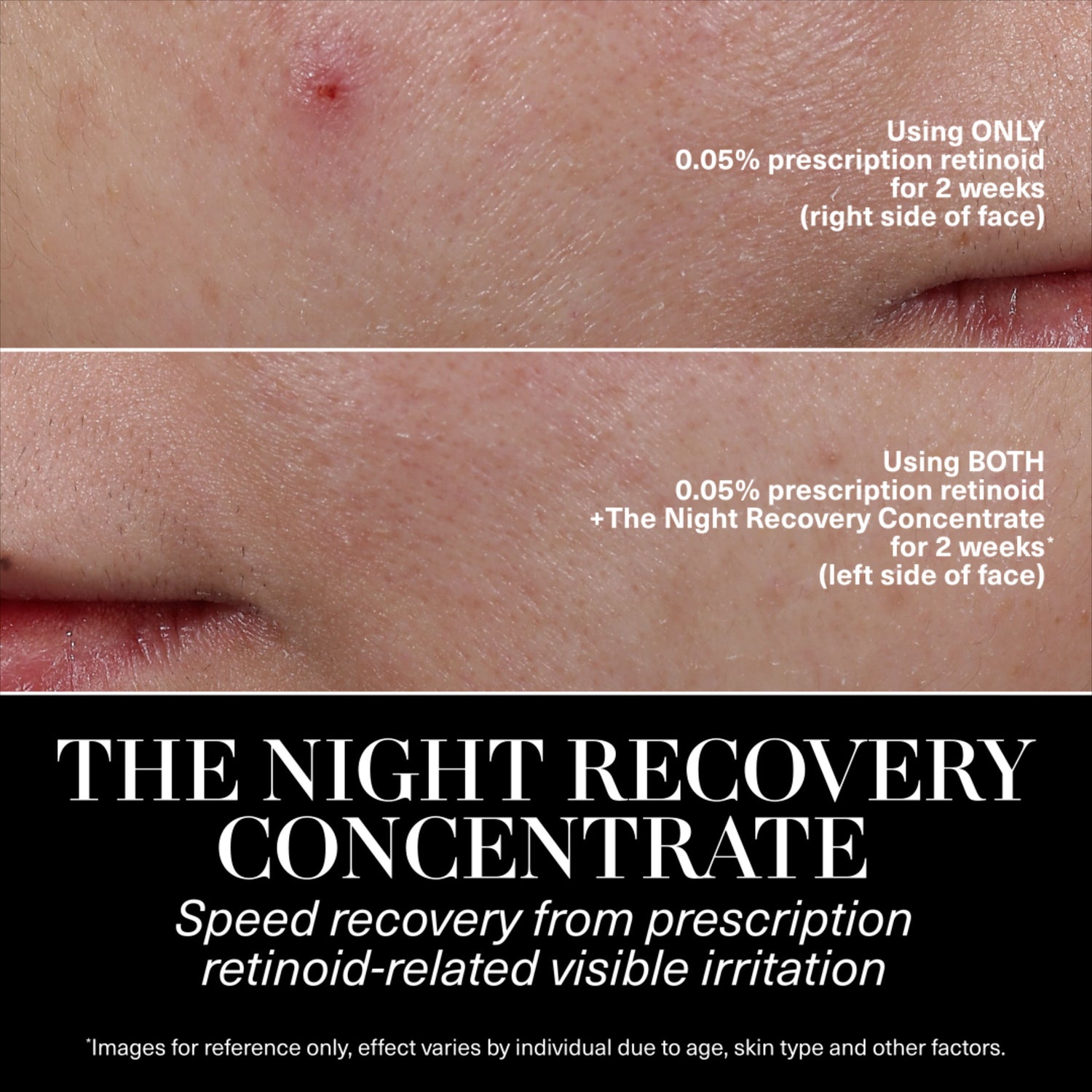 Before and after results of using La Mer The Night Recovery Concentrate Treatment