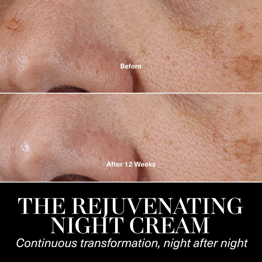 Before and after results of using La Mer The Rejuvenating Night Cream