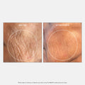 Image of product in the same collection as U Beauty The SMOOTH Dynamic Wrinkle Defense Serum