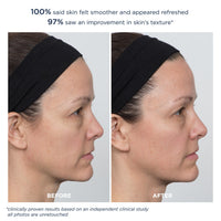 PowerGlow Peel Extra Strength 20%