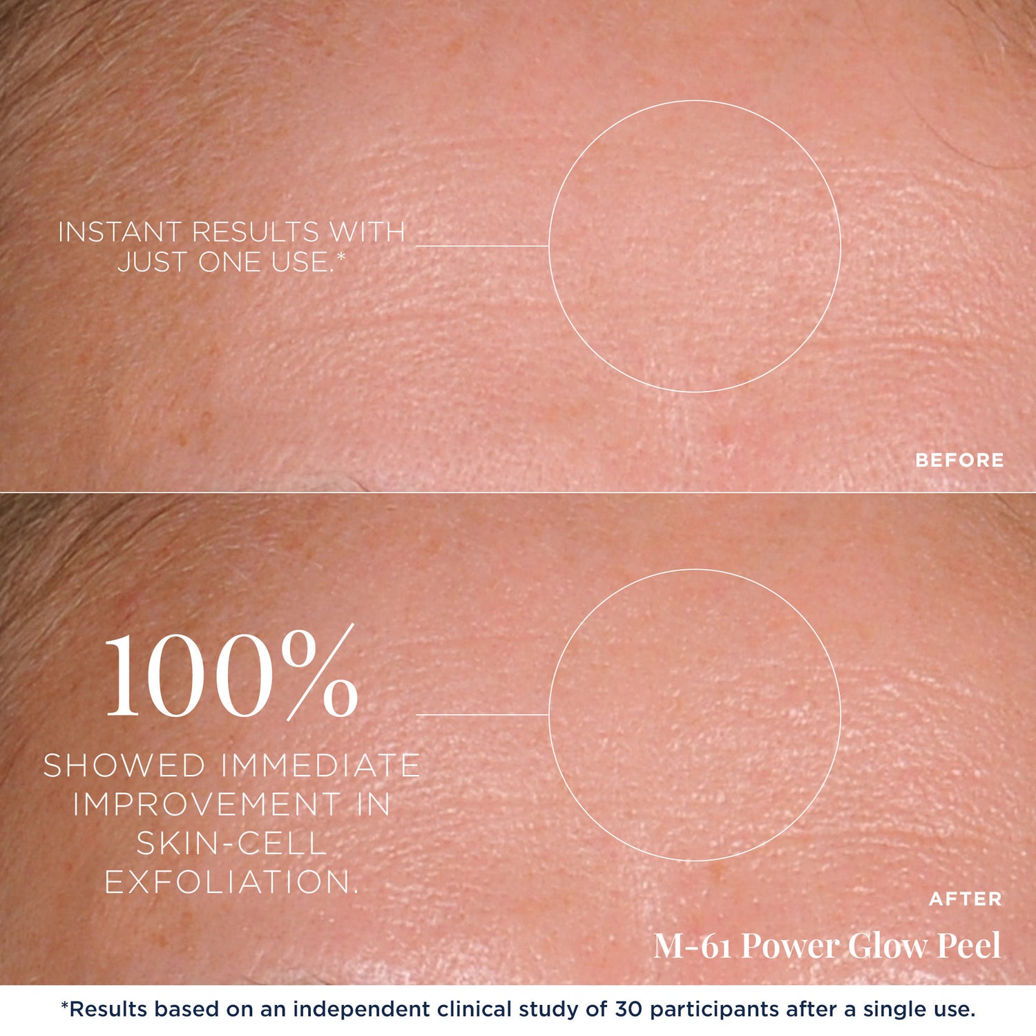 Before and after results of using M-61 PowerGlow Peel