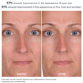 Before and after results of using M-61 PowerGlow Peel