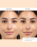 Before and after results of using Patchology Skin Remedy Barrier-Boosting Sheet Mask