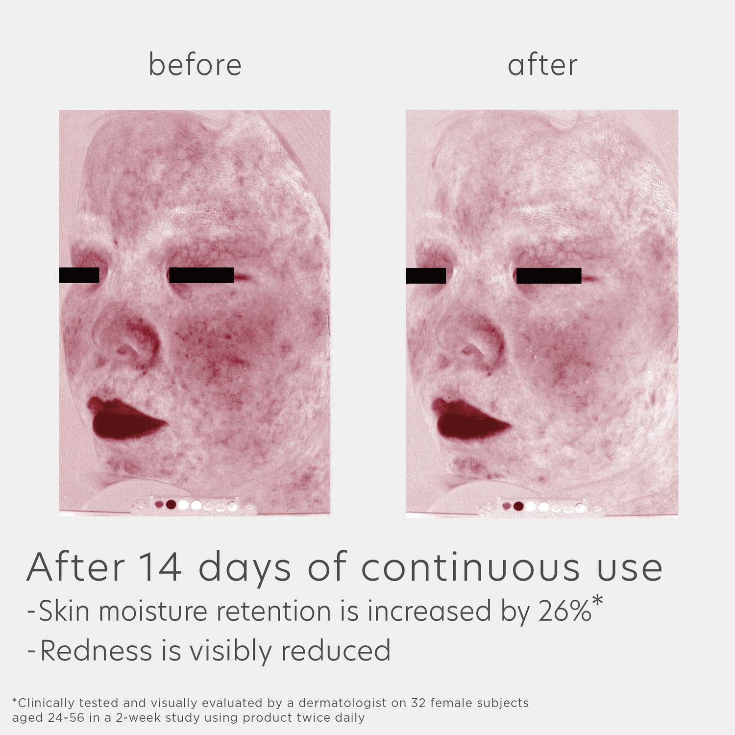 Before and after results of using EltaMD Skin Recovery Amino Acid Foaming Cleanser