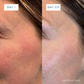 Before and after results of using Element Eight 1 fl oz variant: 1 fl oz
