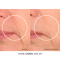 Image of product in the same collection as SIO Super LipLift