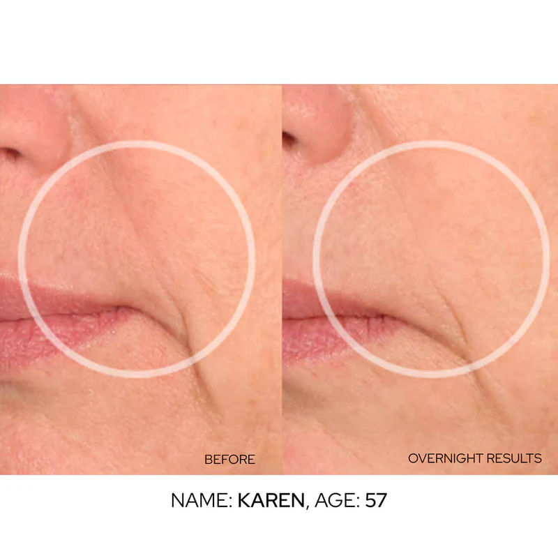 Image of product in the same collection as SIO Super LipLift