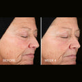 Before and after results of using BeautyStat Universal C Skin Refiner