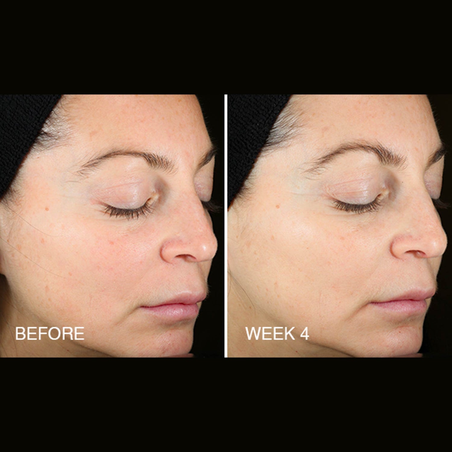 Before and after results of using BeautyStat Universal C Skin Refiner