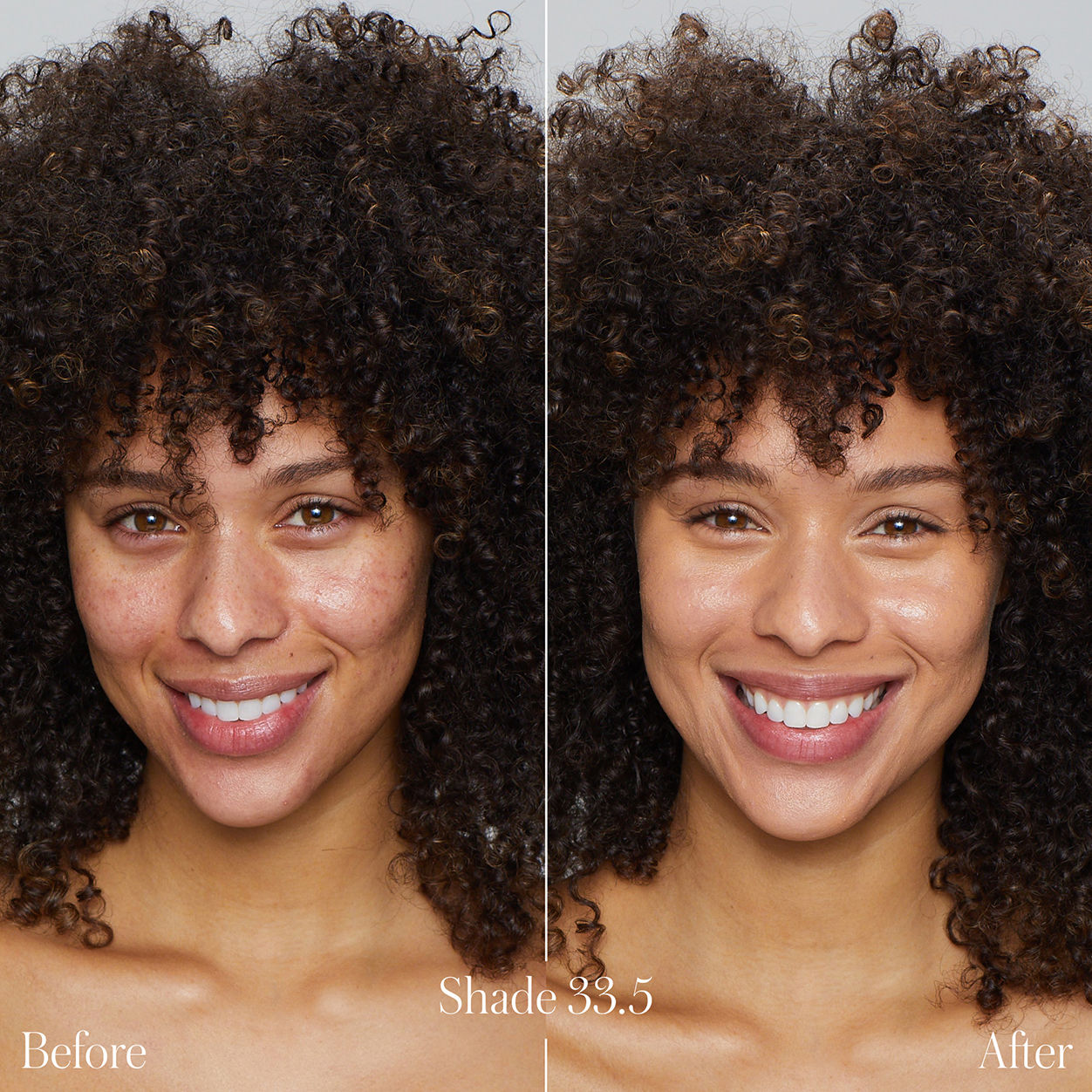 Before and after results of using RMS Beauty UnCoverup Concealer variant: 000